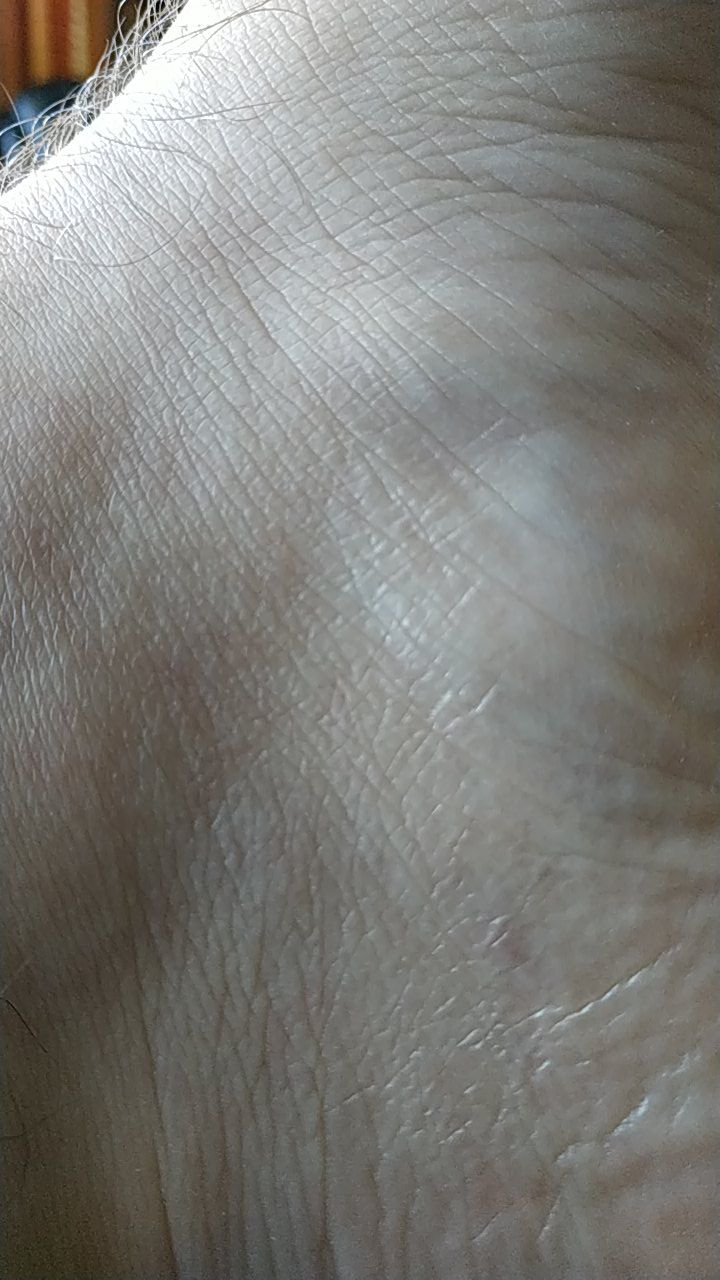 Здорова шкіра: патології не виявлено 💚
